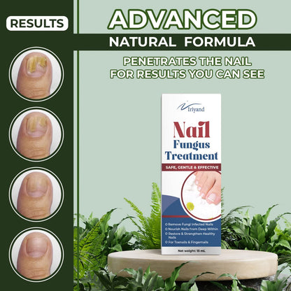 Toenail Fûngus Treatment, Nail Treatment for Toenail, Toe Nail Treatment Extra Strength, Nail Repair for Cracked Damaged Nails and Fingernail, Nail Cure Liquid for Thick, Yellow, Discolored Nail